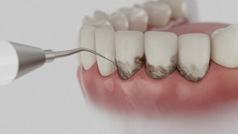 Reliable Dental Implants contractor in Fleming Island, FL by Smile Center Dentistry